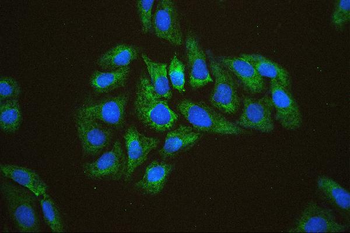 EIF4A1/2/3 Antibody