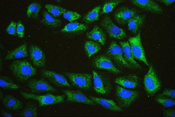 EIF4A1/2/3 Antibody