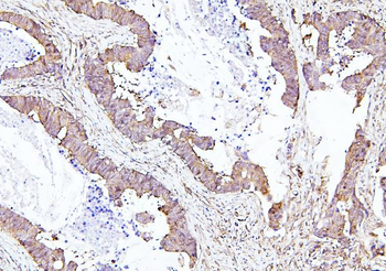 EIF4A1/2/3 Antibody