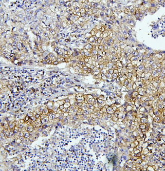EIF4A1/2/3 Antibody