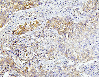 EIF4A1/2/3 Antibody