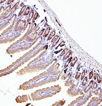 EIF4A1/2/3 Antibody