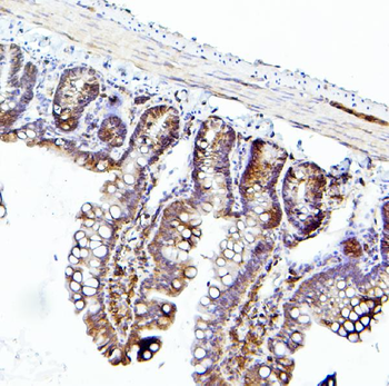 EIF4A1/2/3 Antibody