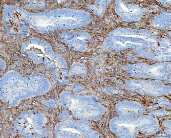 Fibronectin/FN1 Rabbit Polyclonal Antibody