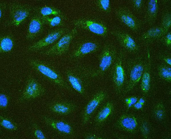Connexin 43/GJA1 Rabbit Polyclonal Antibody