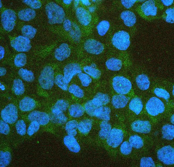 IFNAR2 Antibody