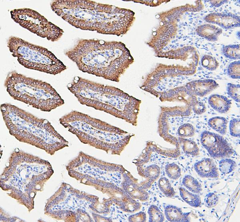 IFNAR2 Antibody