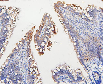 IFNAR2 Antibody