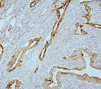 MMP1 Rabbit Polyclonal Antibody