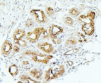 MMP1 Rabbit Polyclonal Antibody