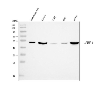MMP1 Rabbit Polyclonal Antibody