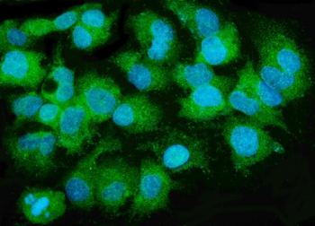 MTTP Rabbit Polyclonal Antibody