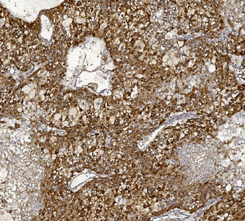 MTTP Rabbit Polyclonal Antibody