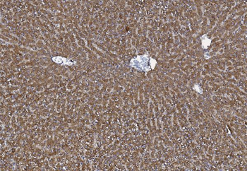 MTTP Rabbit Polyclonal Antibody