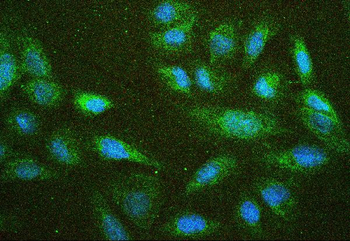 NF2/Merlin Antibody