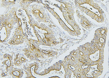 NF2/Merlin Antibody