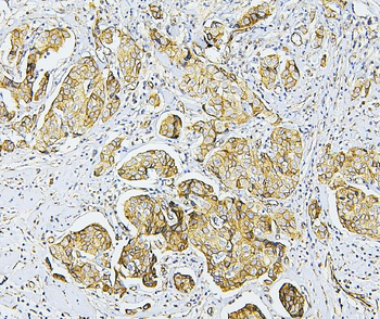NF2/Merlin Antibody