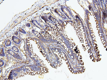 NF2/Merlin Antibody