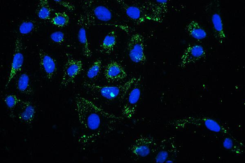 PKC delta/PRKCD Antibody