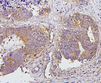 PKC delta/PRKCD Antibody
