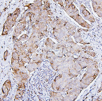 PKC delta/PRKCD Antibody