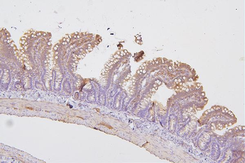 PKC delta/PRKCD Antibody