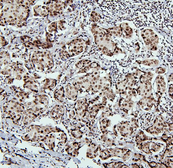 PTBP1 Antibody