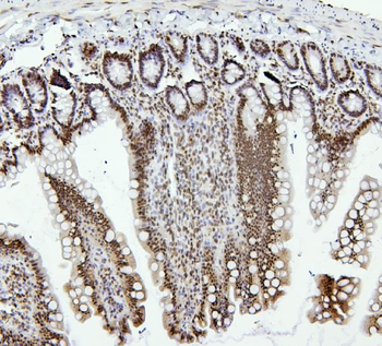 PTBP1 Antibody