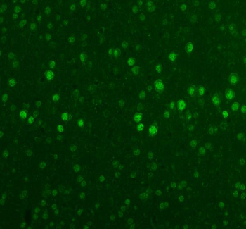 Fox2/RBM9/RBFOX2 Rabbit Polyclonal Antibody