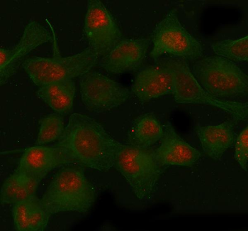 SIRT1 Rabbit Polyclonal Antibody