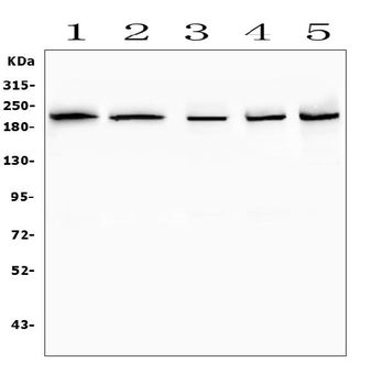 SMARCA2/BRM Antibody