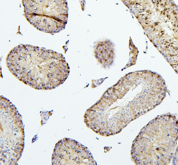 TIE2/TEK Antibody