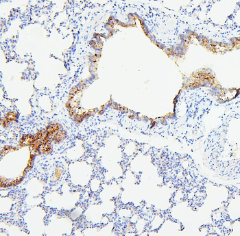 TIE2/TEK Antibody