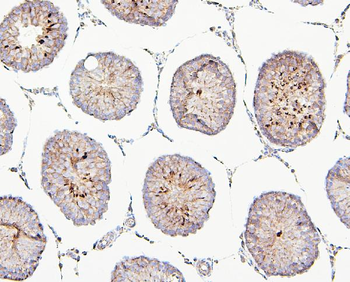 TIE2/TEK Antibody
