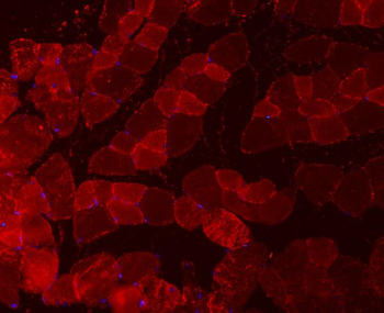 Troponin I fast skeletal muscle/TNNI2 Rabbit Polyclonal Antibody