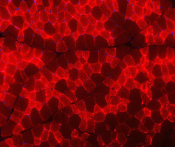 Troponin I fast skeletal muscle/TNNI2 Rabbit Polyclonal Antibody
