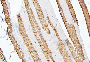 Troponin I fast skeletal muscle/TNNI2 Rabbit Polyclonal Antibody