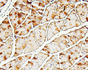 Troponin I fast skeletal muscle/TNNI2 Rabbit Polyclonal Antibody