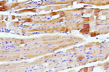 Troponin I fast skeletal muscle/TNNI2 Rabbit Polyclonal Antibody
