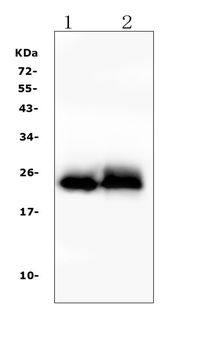 Troponin I fast skeletal muscle/TNNI2 Rabbit Polyclonal Antibody