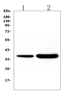 TNNT3 Rabbit Polyclonal Antibody