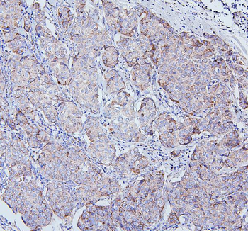 TRPV3 Rabbit Polyclonal Antibody