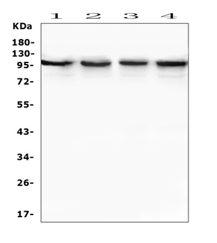 TRPV3 Rabbit Polyclonal Antibody