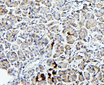 TRPV5 Antibody