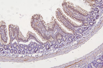 Thioredoxin 2/TXN2 Antibody