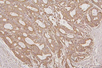 Thioredoxin 2/TXN2 Antibody