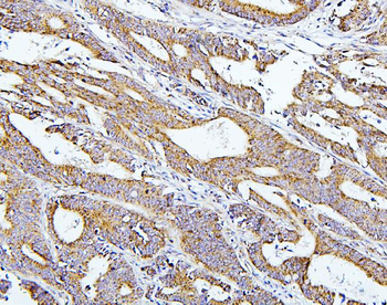 Thioredoxin 2/TXN2 Antibody