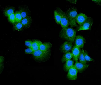 Aldolase/ALDOA Antibody