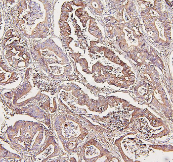 Aldolase/ALDOA Antibody