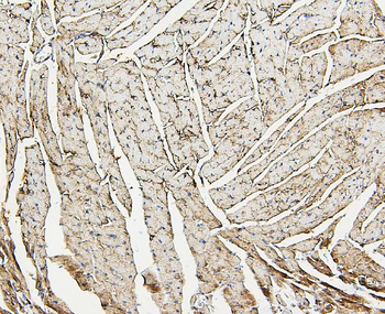 Aldolase/ALDOA Antibody
